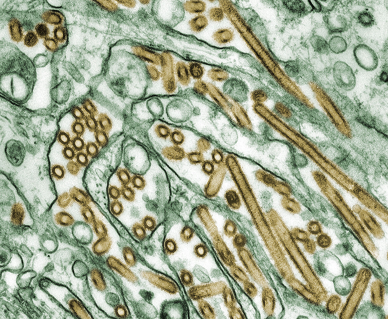 1280px Colorized transmission electron micrograph of Avian influenza A H5N1 viruses