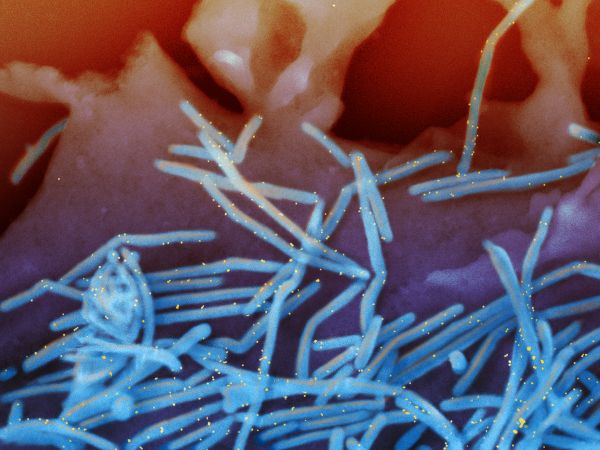 Human Respiratory Syncytial Virus RSV 33114415716